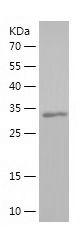 Recombinant Human HCRTR1