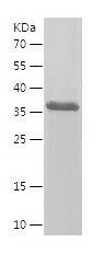 Recombinant Human ACKR2