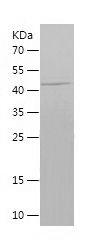 Recombinant Human NR3C1