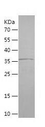 Recombinant Human ABHD5