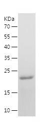 Recombinant Human RORB