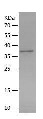 Recombinant Human FLT4