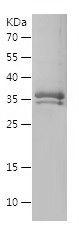 Recombinant Human AGTR1