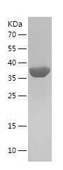 Recombinant Human akr1b10