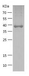 Recombinant Human AGGF1