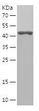 Recombinant Human ALDH3A1