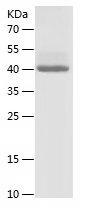 Recombinant Human CD271