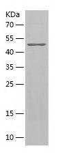 Recombinant Human AIMP2