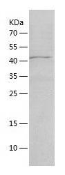 Recombinant Human ACSL5