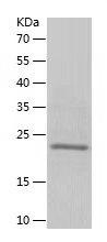 Recombinant Human fgf21