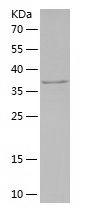 Recombinant Human CARD9