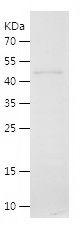 Recombinant Human PCSK9