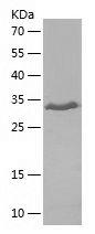 Recombinant Human DRD5