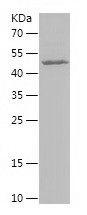 Recombinant Human BMPR1A