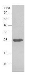 Recombinant Human BAG2