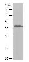 Recombinant Human ITGA1