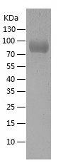 Recombinant Human AFM