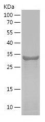 Recombinant Human PHF5A