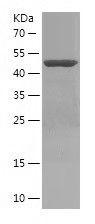 Recombinant Human IGSF11