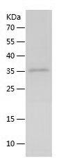 Recombinant Rat IL-21