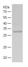 Recombinant Human ICAD