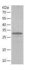 Recombinant Human AKR1B10