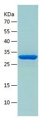 Recombinant Human alpha Actinin