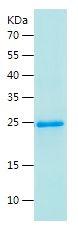 Recombinant Human ICAM2