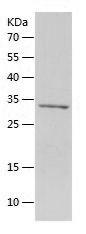 Recombinant Human IGFBP3