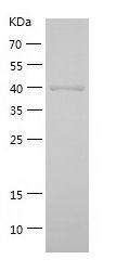 Recombinant Human ADH6