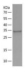 Recombinant Mouse IL-12