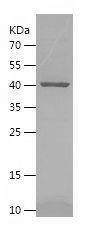 Recombinant Human SerpinB8