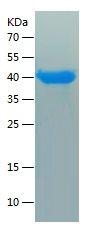 Recombinant Human SET