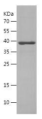 Recombinant Human MCL1