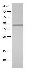 Recombinant Human SQSTM1 