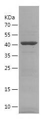 Recombinant Human IGSF11