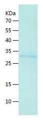 Recombinant Human METRNL