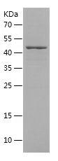 Recombinant Human ACSM5