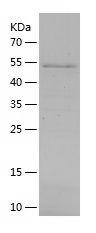 Recombinant Human ANGPTL6