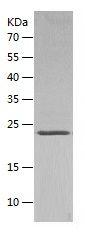 Recombinant Human FGF21