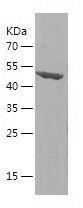 Recombinant Human CPS1