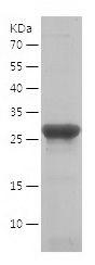 Recombinant Human LAMTOR5