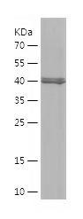 Recombinant Human ALDH1A3