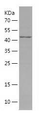 Recombinant Human ALDH1B1