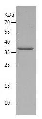 Recombinant Human AKAP7