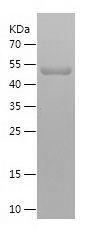 Recombinant Human AKAP12