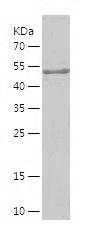 Recombinant Human ANP32B