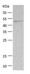 Recombinant Human HTR3A