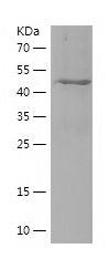 Recombinant Human CORO1C