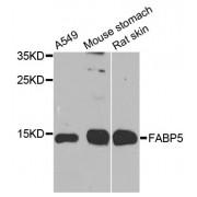 Fatty Acid Binding Protein 5, Epidermal (FABP5) Antibody
